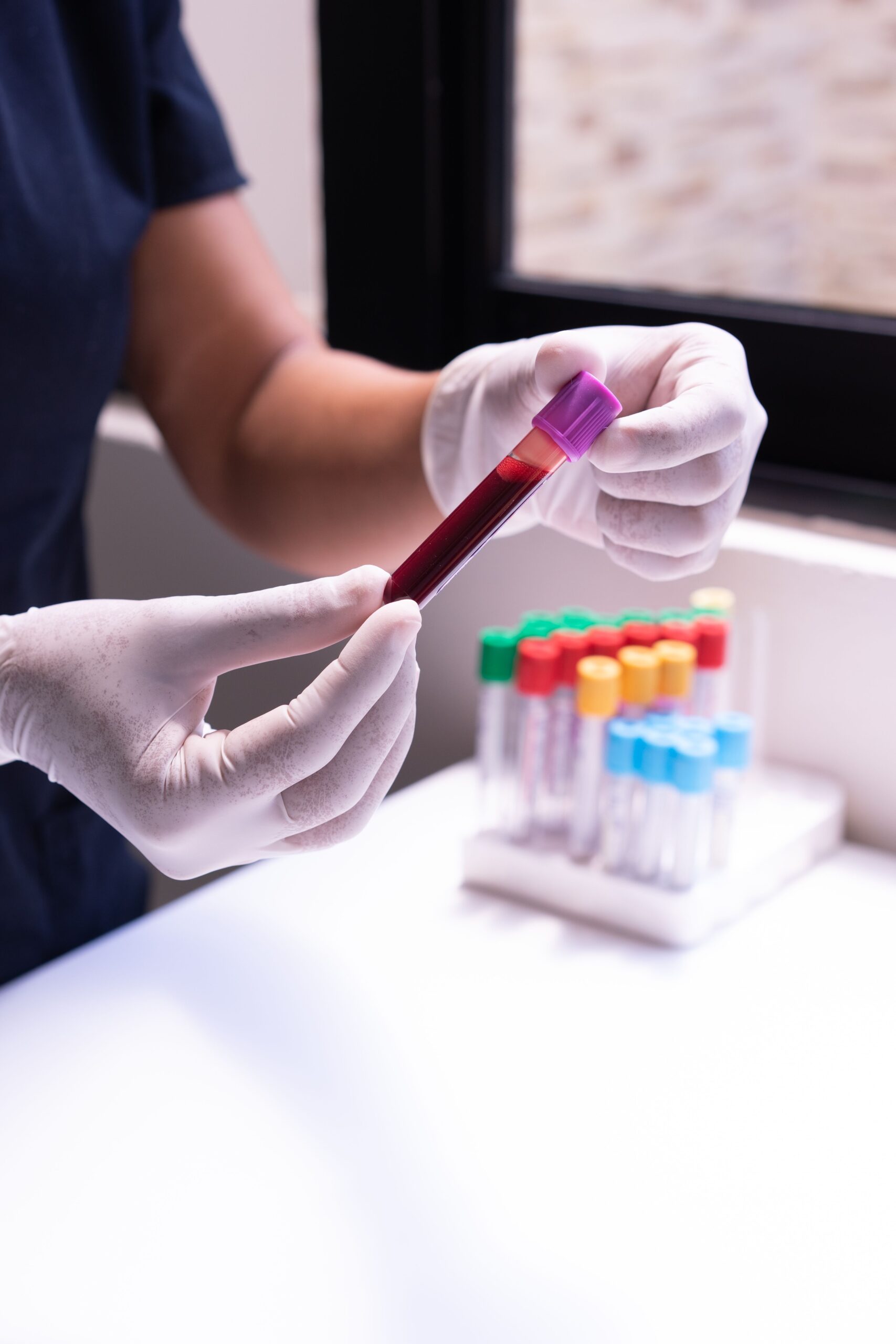A gloved hand holding a blood sample in a test tube